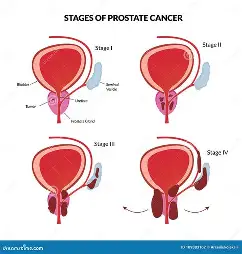 prostanu urinary flow support illustration 2